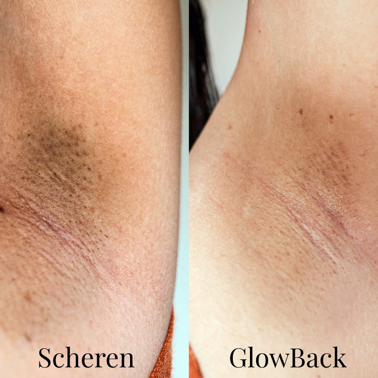 GlowBack 2-in-1 Trimmer